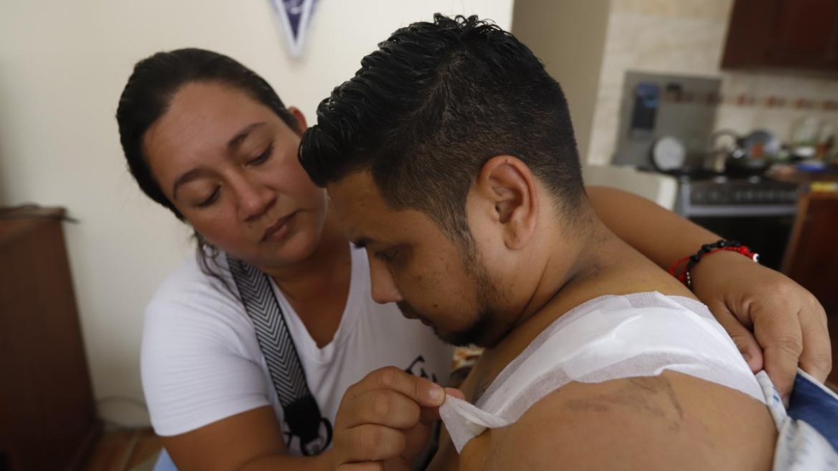 Eduardo aún se recupera de su herida. Se le dictaminó que cumpla arresto domiciliario mientras es investigado por ataque y resistencia