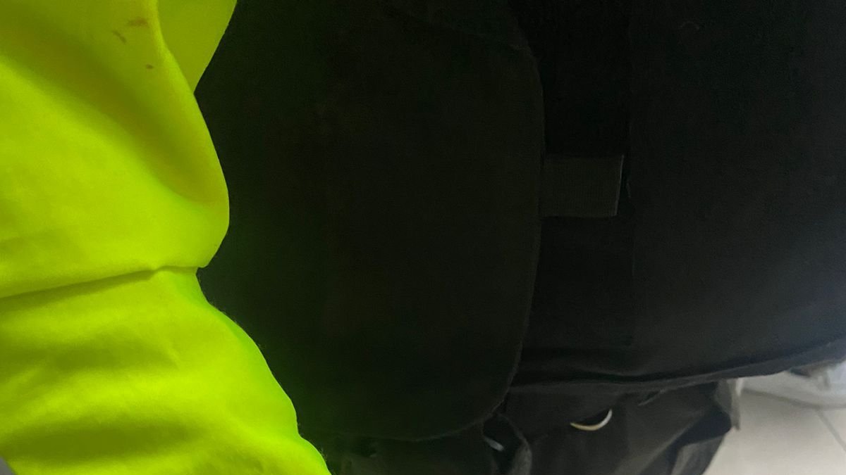 El uniformado sufrió heridas en el rostro y en la cabeza