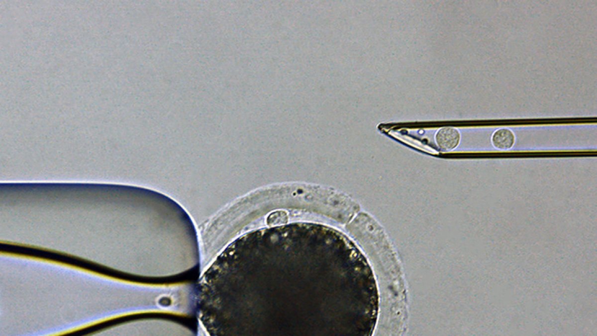 Proceso de clonación de un cerdo modificado genéticamente para reducir el riesgo de rechazo por parte de un receptor humano en un xenotrasplante.