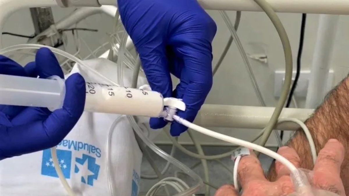 Proceso. Después de la sedación, el paciente podría sentir ciertos mareos