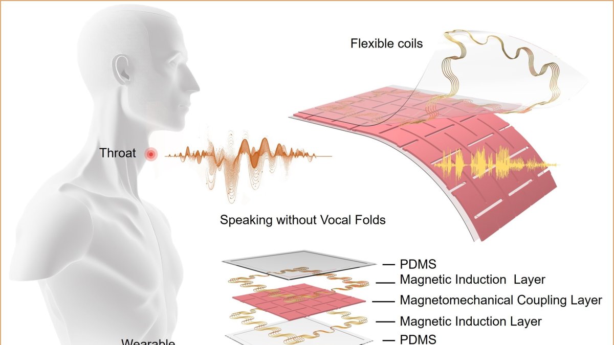 Imagen en la que se explica la estructura del dispositivo.