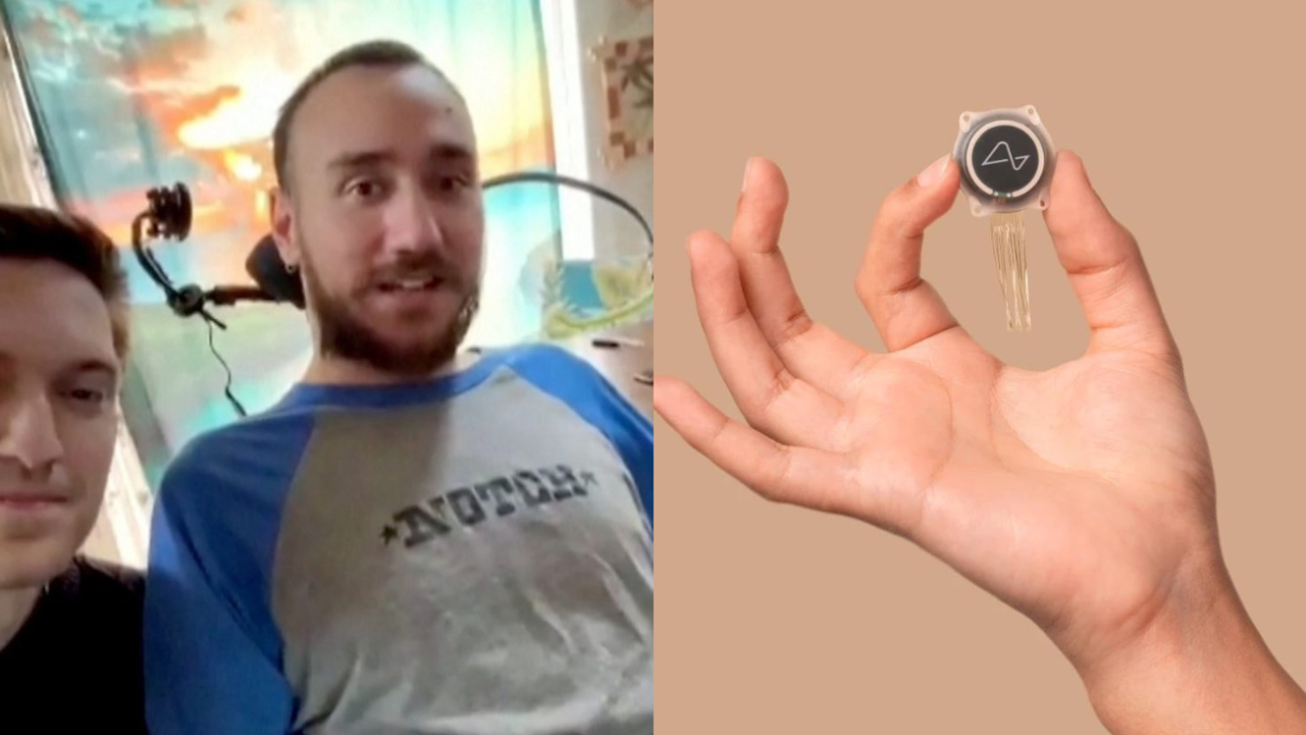 Noland Arbaugh, un hombre con parálisis, se ha convertido en el primer humano en implantarse uno de los prototipos de Neuralink