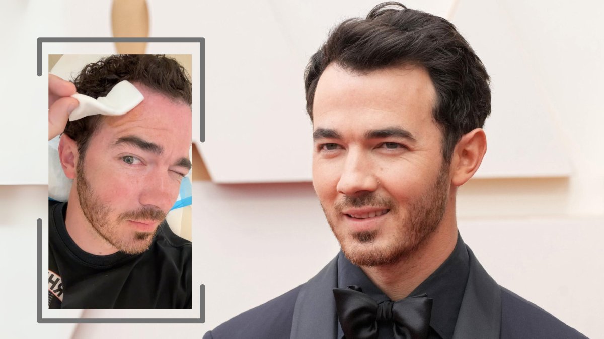 Nick Jonas fue operado por un carcinoma basocelular.