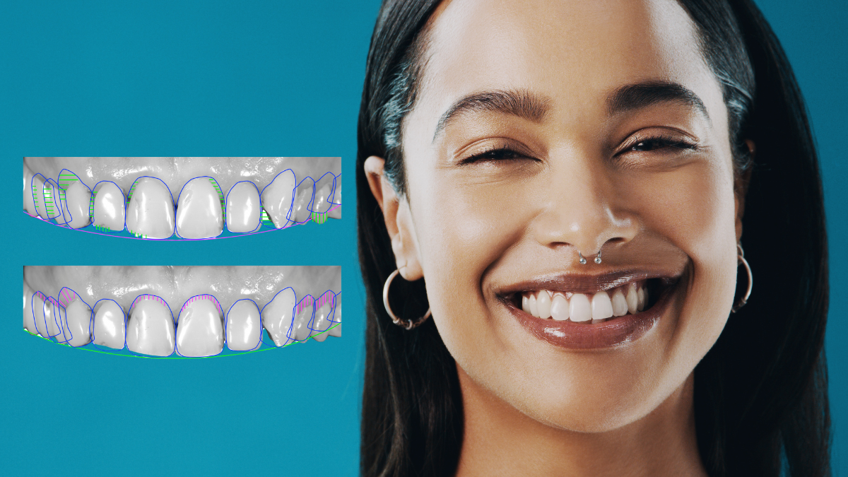 El diseño de sonrisa es un tratamiento personalizado combina tecnología avanzada con técnicas estéticas.