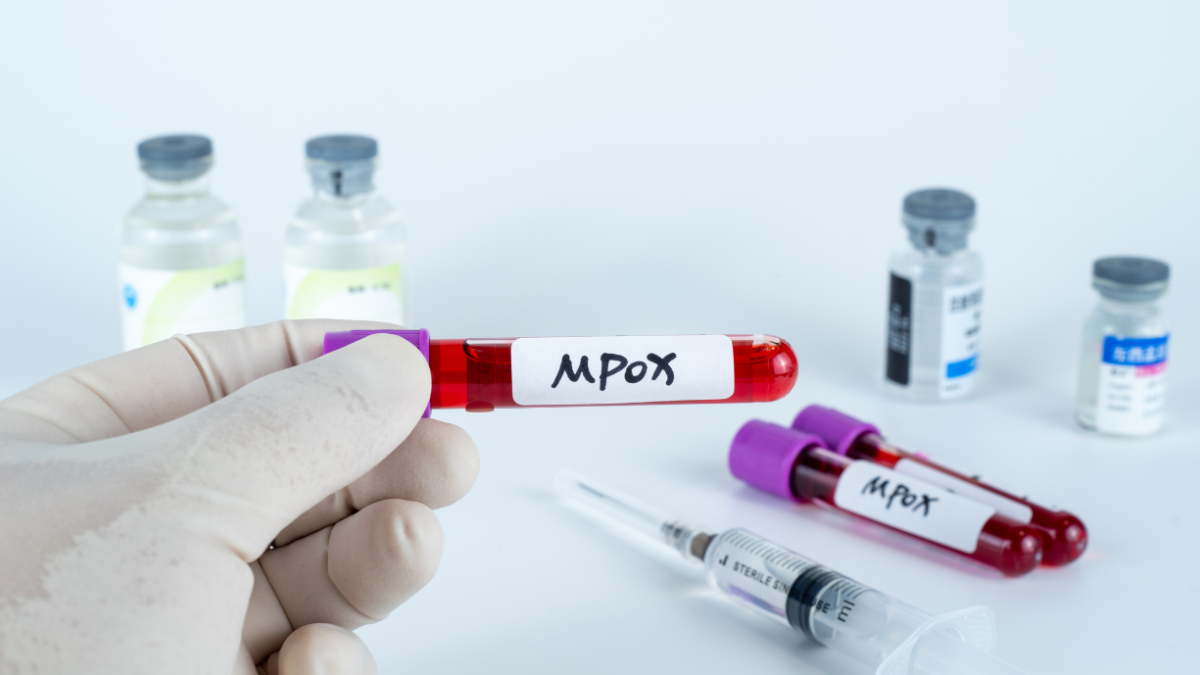 La mejor forma de detectar la presencia de la viruela del mono es a través de pruebas de laboratorio.