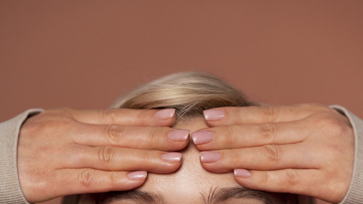 La prevención y un tratamiento adecuado son esenciales para lograr una piel saludable y hermosa.