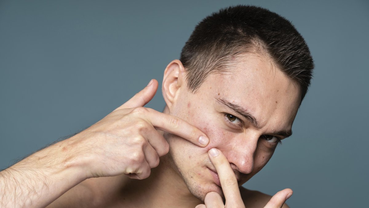 Antes de extraer los puntos negros hay que retirar el exceso de grasa con un limpiador.