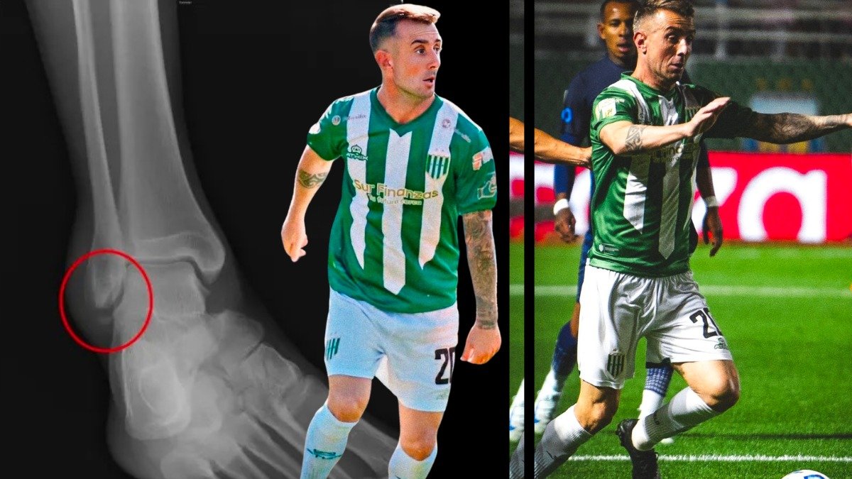 Damián Díaz tiene una lesión del maléolo externo.