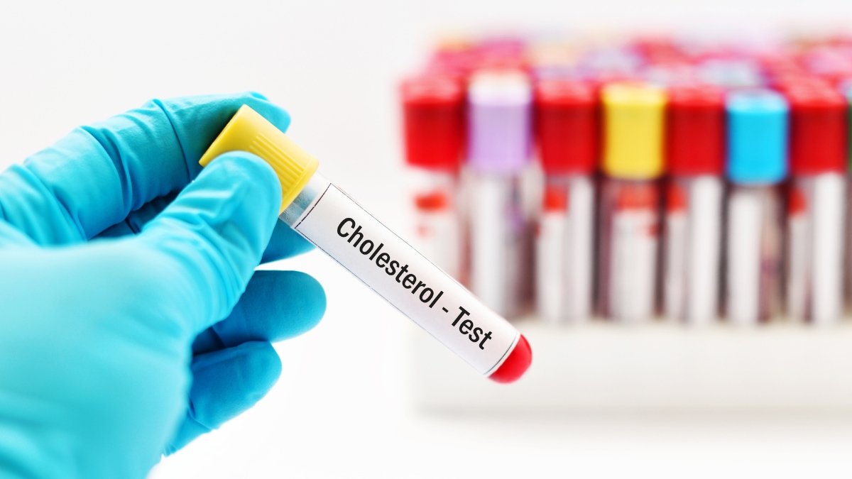 Descubre qué niveles de colesterol deberías tener según tu edad.