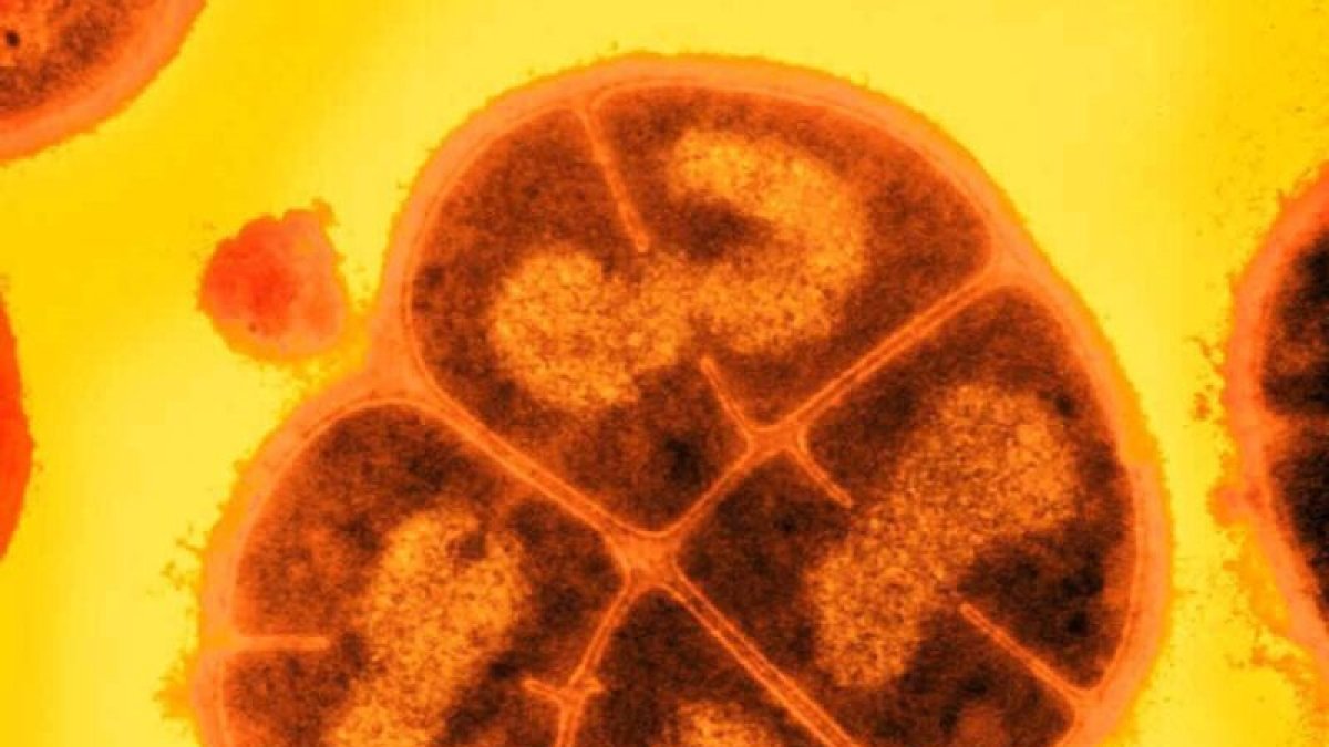 Apodada «la bacteria Conan» por su extraordinaria capacidad para tolerar las condiciones más duras, Deinococcus radiodurans puede soportar dosis de radiación extremas.