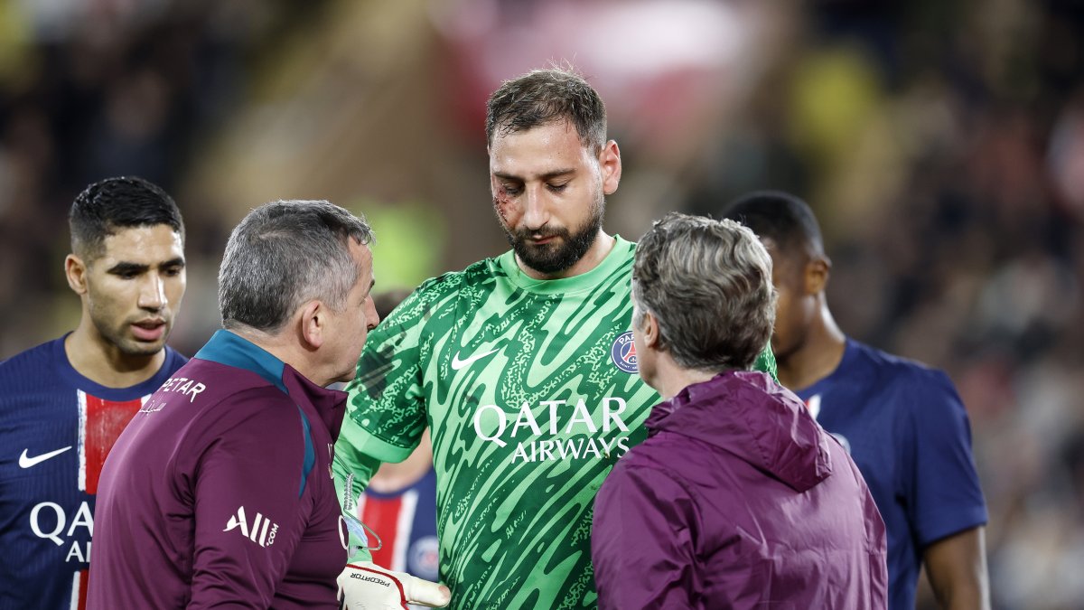 Gianluigi Donnarumma (c) fue asistido de inmediato por el cuerpo médico de PSG