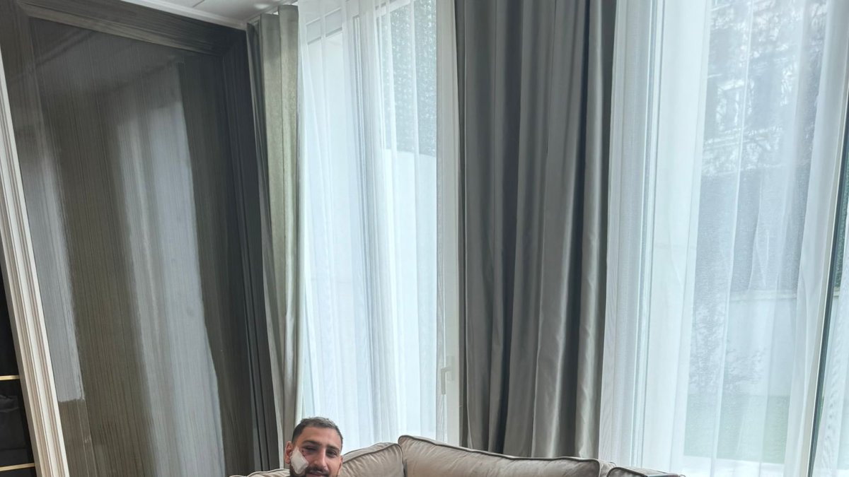 Gianluigi Donnarumma posteó esta foto luego de sufrir el golpe en su rosto. Se está recuperado