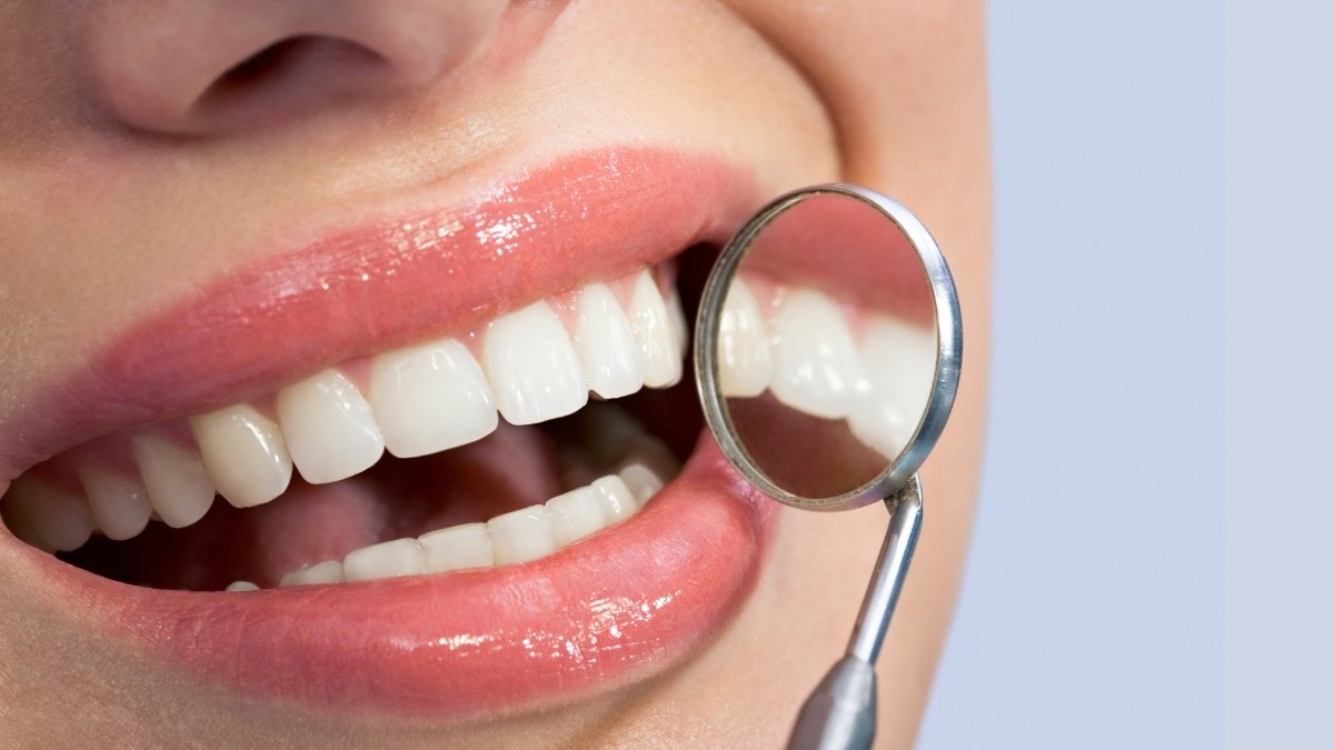 Estrategias efectivas para mantener una sonrisa libre de sarro.