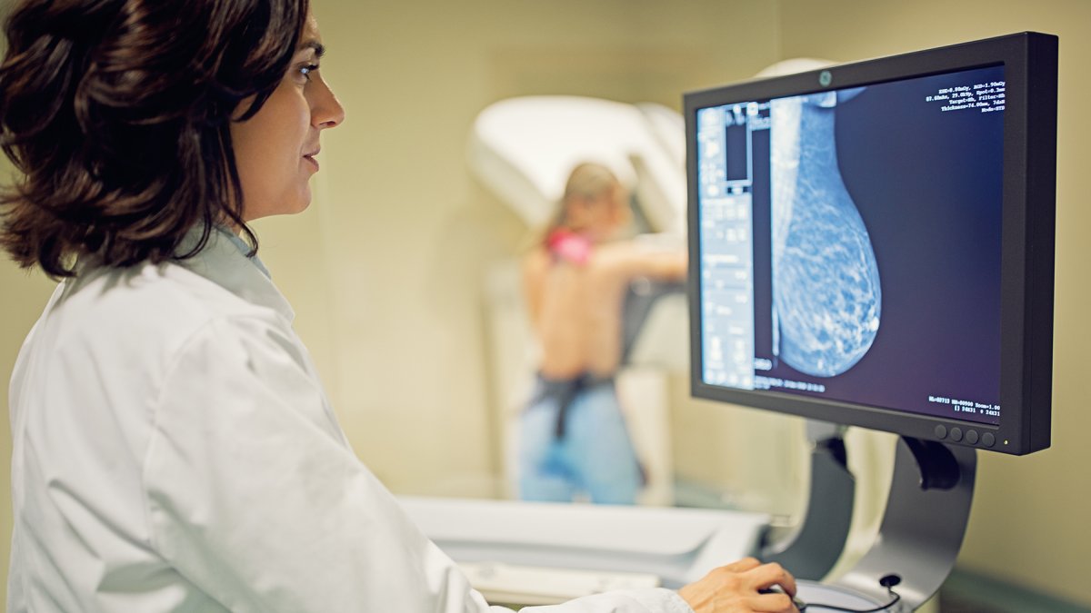 En la actualidad existen herramientas que permiten una detección temprana del cáncer, como los biomarcadores tumorales.