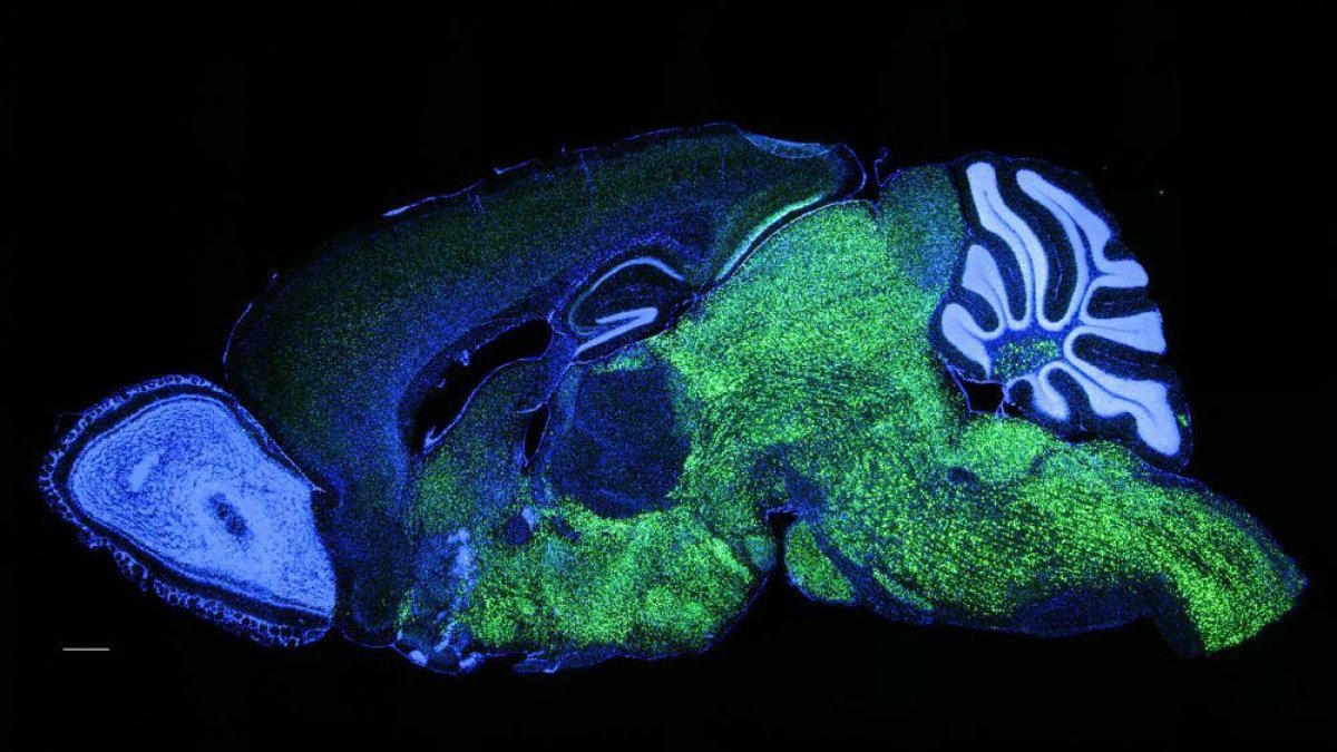 Patrón de expresión de NOVA1 en el cerebro de ratón. NOVA1 en verde, núcleos (DAPI) en azul.