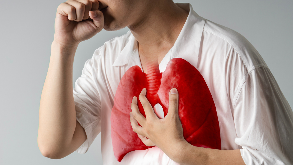 Referencial. La tuberculosis afecta principalmente los pulmones