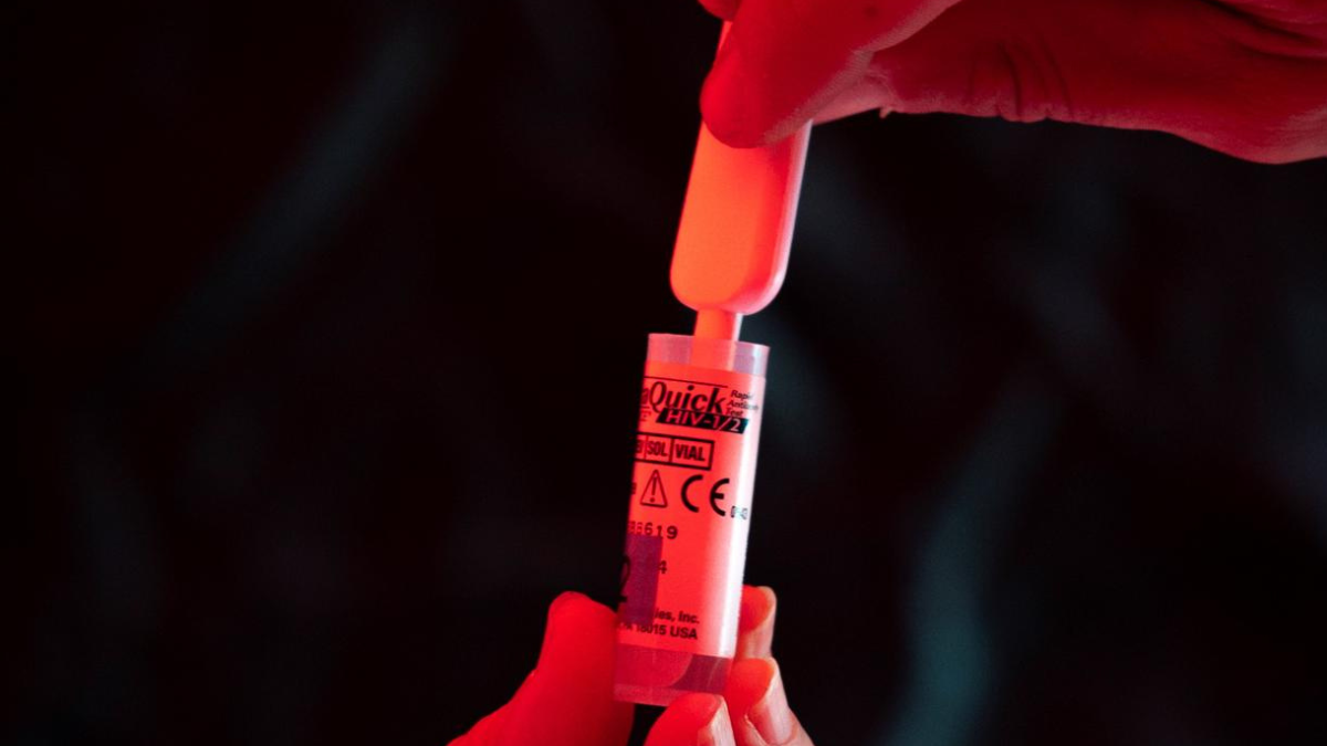 En la imagen de archivo, una persona se realiza una prueba rápida, anónima y gratuita de VIH. EFE/Biel Aliño