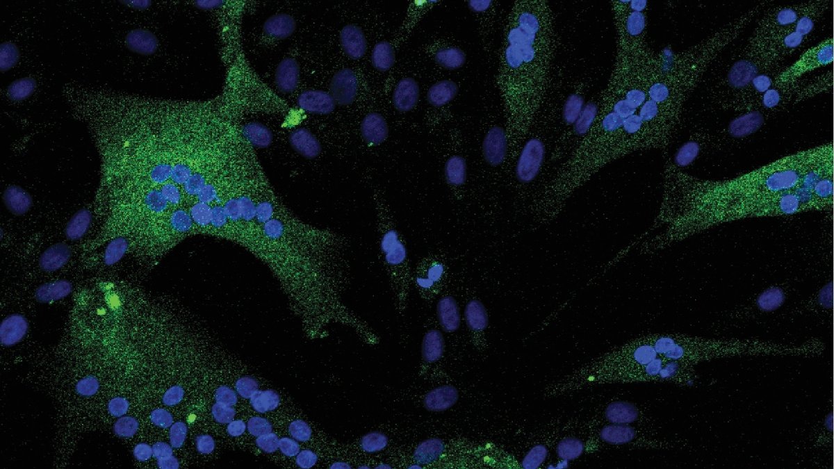 El estudio molecular de la fibra muscular de un caballo de carreras pura sangre ha revelado una adaptación genética para hacerle más atlético. 