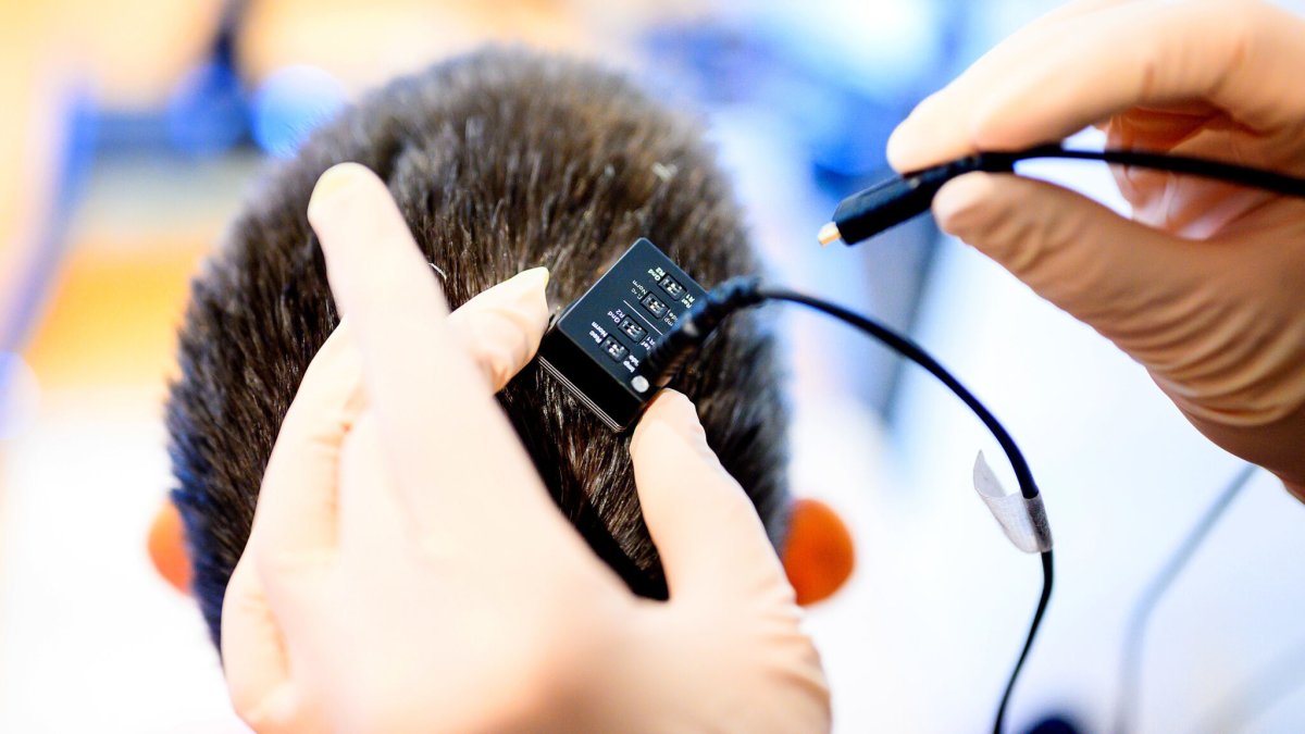 Momento en el que los investigadores conectan el implante cerebral a la computadora sintetizadora de voz.