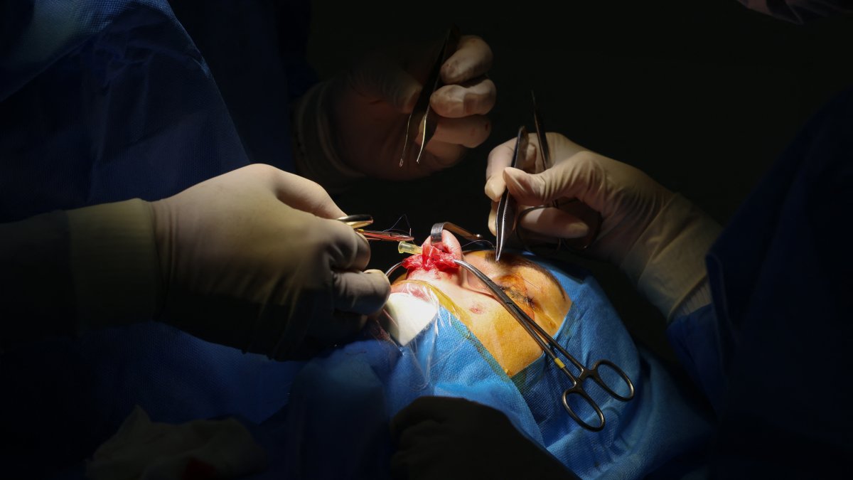 El cirujano iraní Hamidreza Hosnani realiza una operación de nariz en su clínica privada en Teherán.