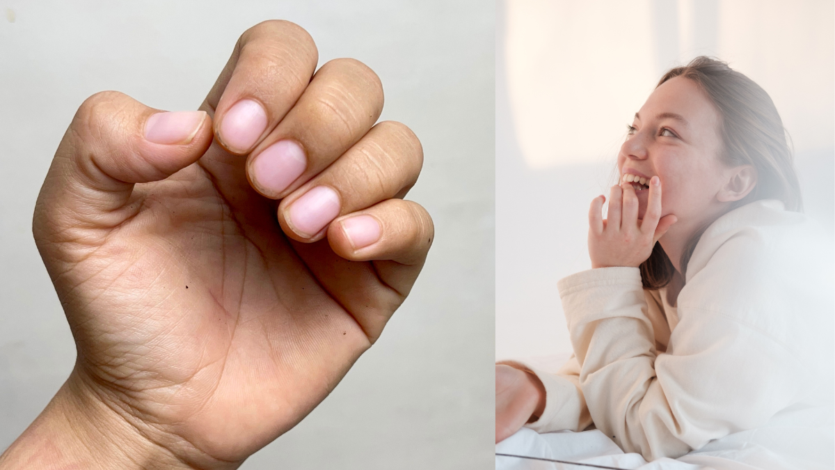 Un hábito común como morderse las uñas puede traer problemas de salud a las personas