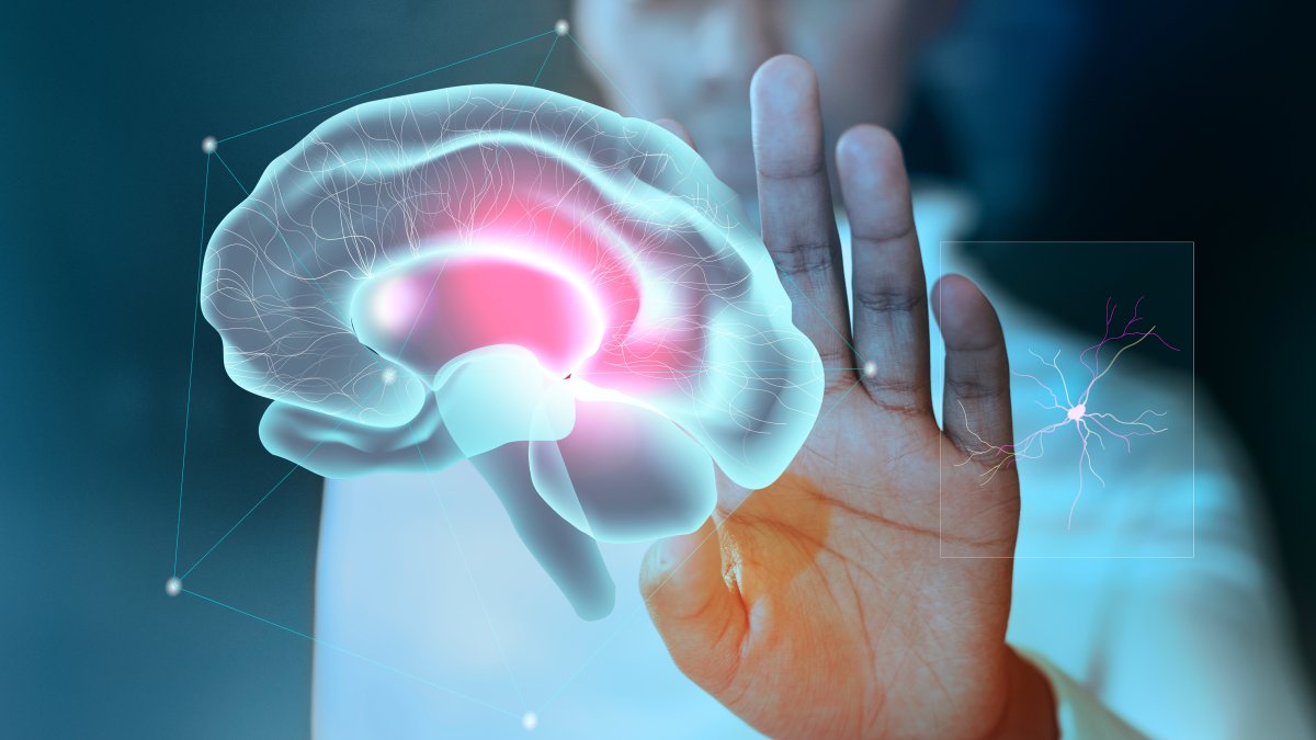 La hidrocefalia es un exceso de líquido