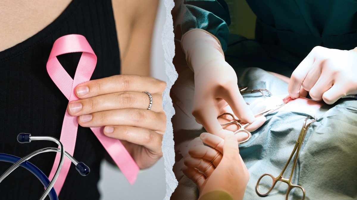 Las mujeres que superaron el cáncer de mama podrán acceder al beneficio en Guayaquil.