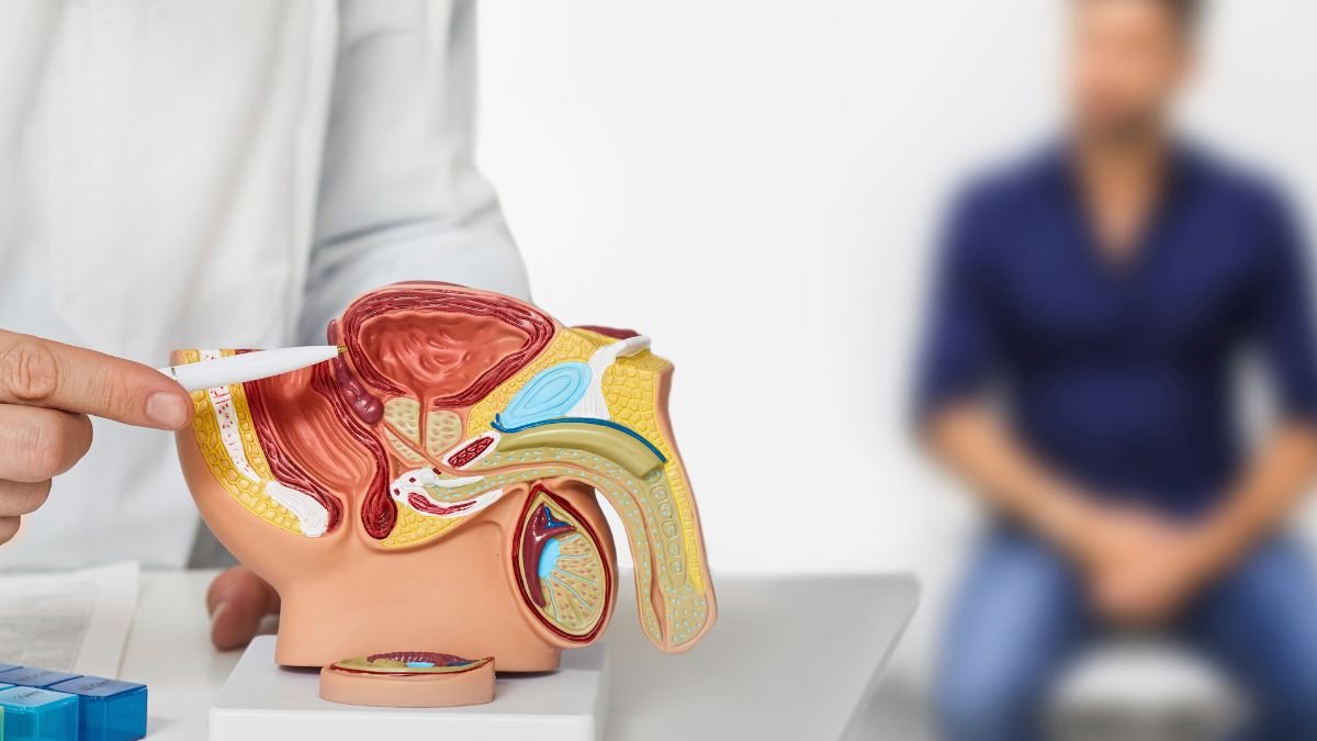 Mitos impiden detección oportuna del cáncer de próstata