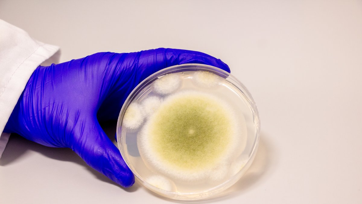 Una muestra de Aspergillus flavus cultivada en el laboratorio Gao.