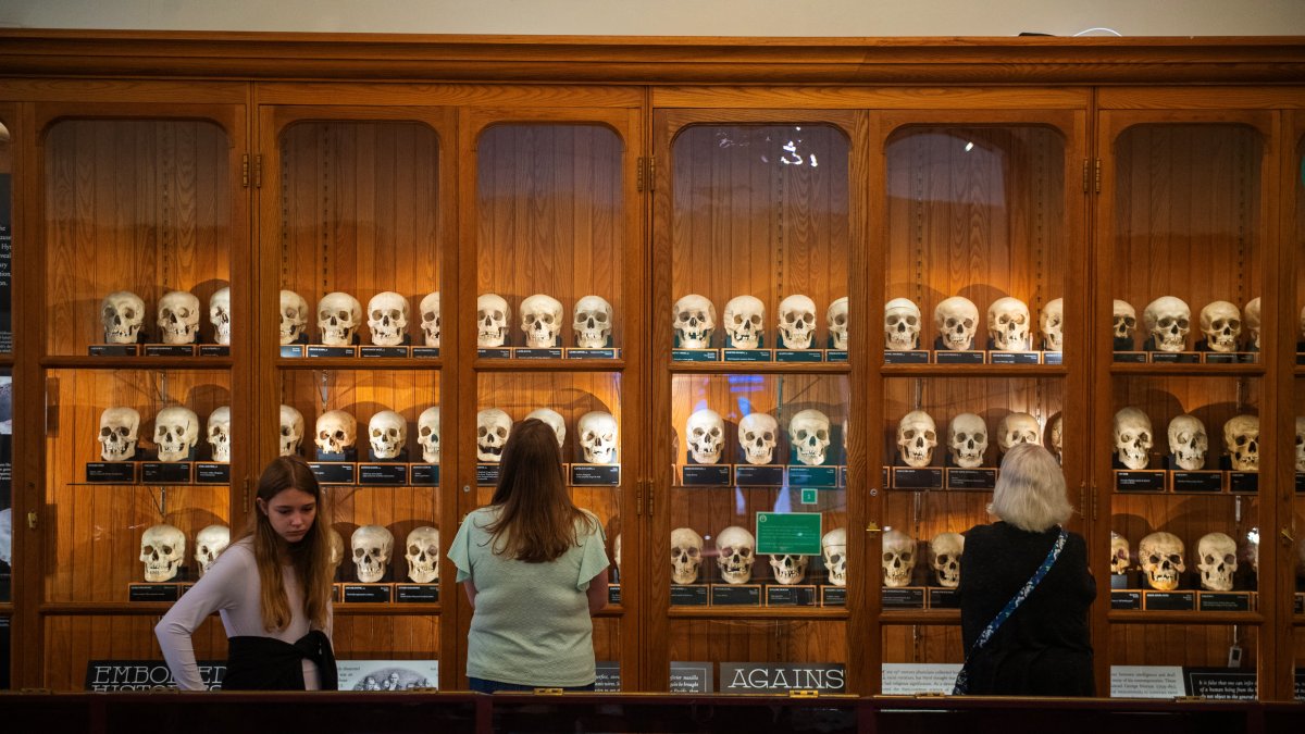 Museo.Los visitantes examinan una exhibición de cráneos de la Colección Josef Hyrtl en el Museo Mütter.