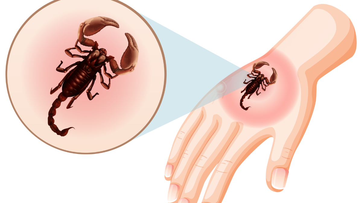 Imagen simbólica de picadura de alacrán.