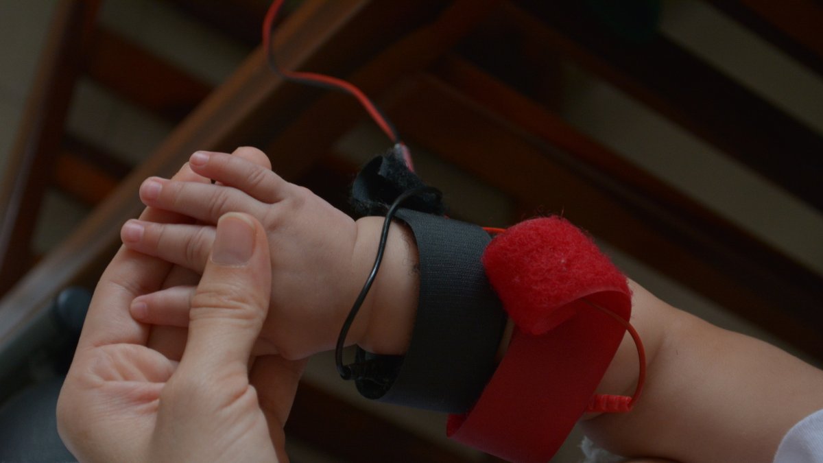 En la Fundación realizan la prueba para determinar si la persona tiene fibrosis quística pulmonar.