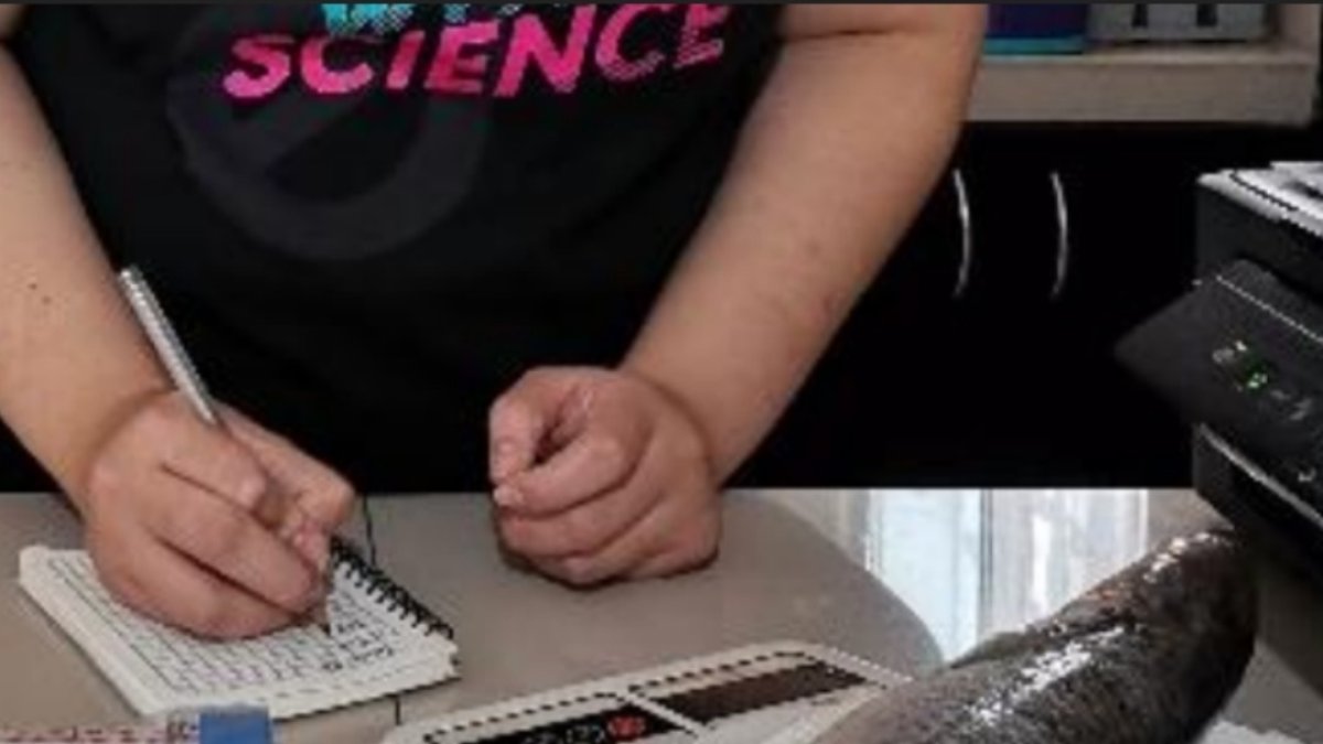 Parte del estudio de lisa para la detección de parásitos.