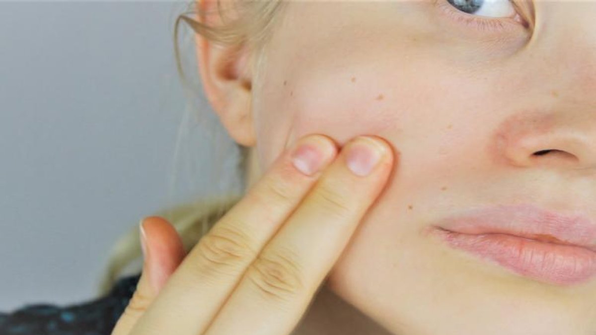 Las enfermedades de la piel afectan a personas de todas las edades.