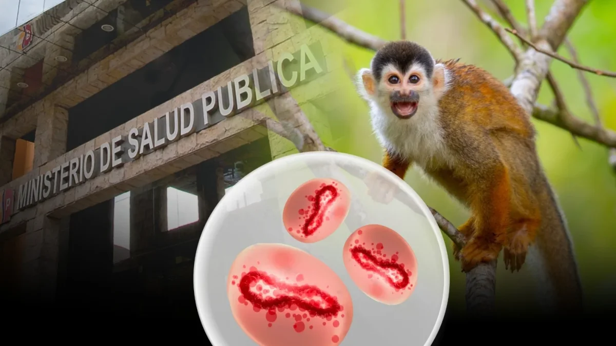 Viruela del mono mantiene en alerta al sistema de salud pública