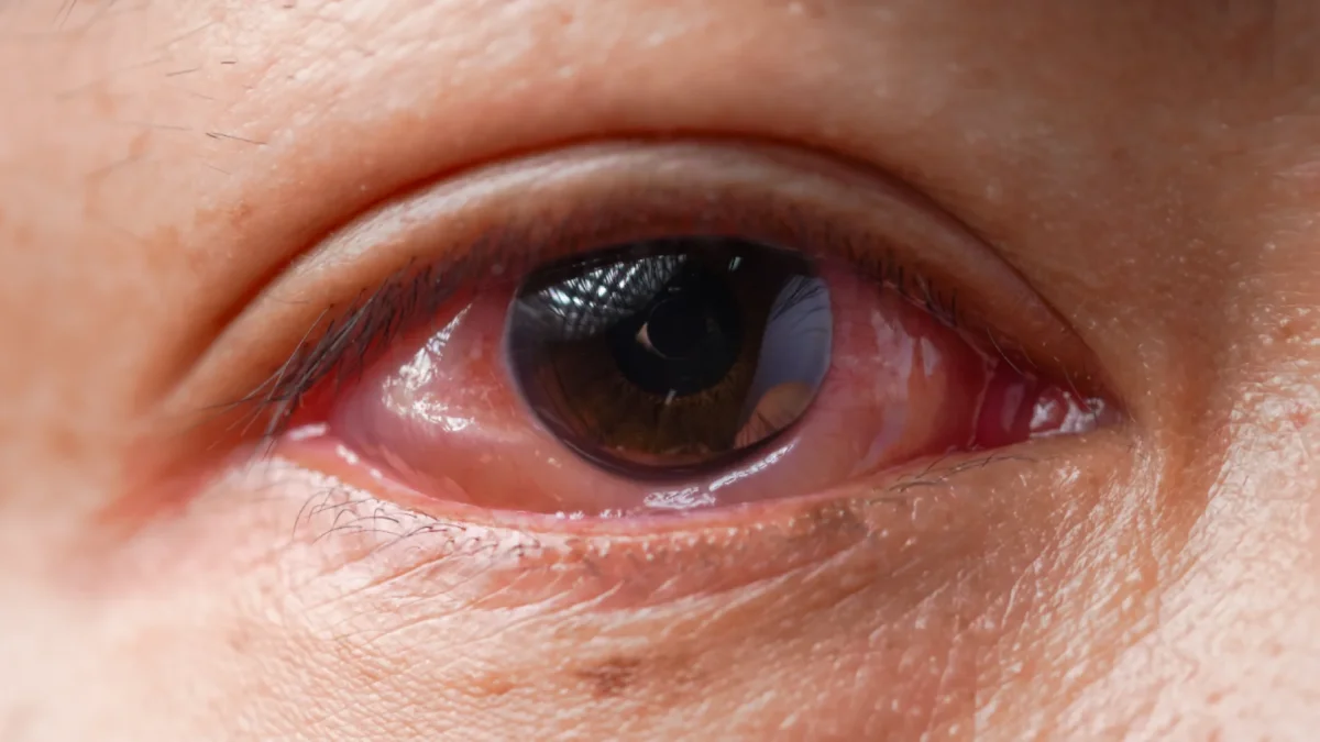 El CMNV deja el océano y entra en la salud humana.