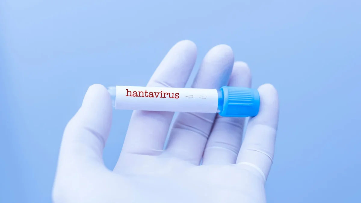 Muestra etiquetada como hantavirus en laboratorio, en medio de la alerta sanitaria internacional por posibles brotes.