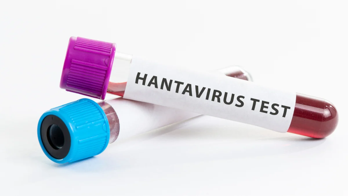 Hantavirus vs. Covid-19: Estas son las diferencias entre ambas enfermedades