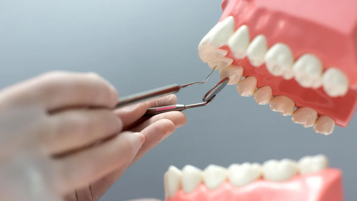 El programa de implantes dentales gratuitos, de la Universidad Católica de Santiago de Guayaquil (UCSG) tendrá 40 cupos.