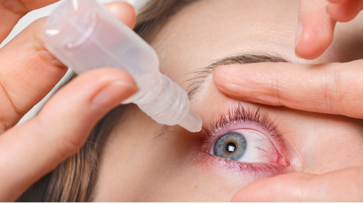 La conjuntivitis también es conocida coloquialmente como patada china.