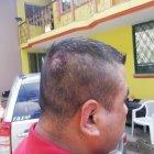 Así quedó la cabeza del hombre que se enfrentó a golpes con Jaime Iván Kaviedes.