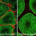 celulas progenitoras normales y mutantes.