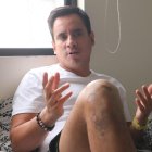 Ciclista sobreviviente del accidente en la vía a Samborondón cuenta su historia.