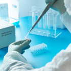 El paquete cuenta con una sensibilidad mayor que otros disponibles en el mercado, según la UDLA, que espera producir mil kits con 100.000 reacciones de PCR.