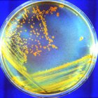 El Deinococcus radiodurans (bautizado como "Conan la Bacteria") está especialmente indicada para sobrevivir al duro entorno de Marte.