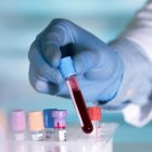 Una prueba rutinaria de sangre permitirá conocer cuáles son las probabilidades de desarrollar ciertas enfermedades.