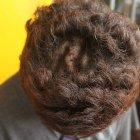 El hincha canario, "Jordan", muestra a EXPRESO las suturas que tiene en su cabeza tras sobrevivir al accidente mortal en Perú.