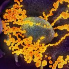 Imagen de microscopio electrónico que muestra (objetos en amarillo) al SARS-CoV-2, el virus que causa el brote del coronavirus COVID-19.