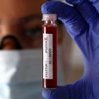 Hasta ayer, se habían registrado 1.627 casos de Covid-19 a nivel nacional.