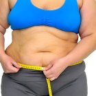 Tener exceso de peso eleva tus riesgos de sufrir obesidad tipo 2.